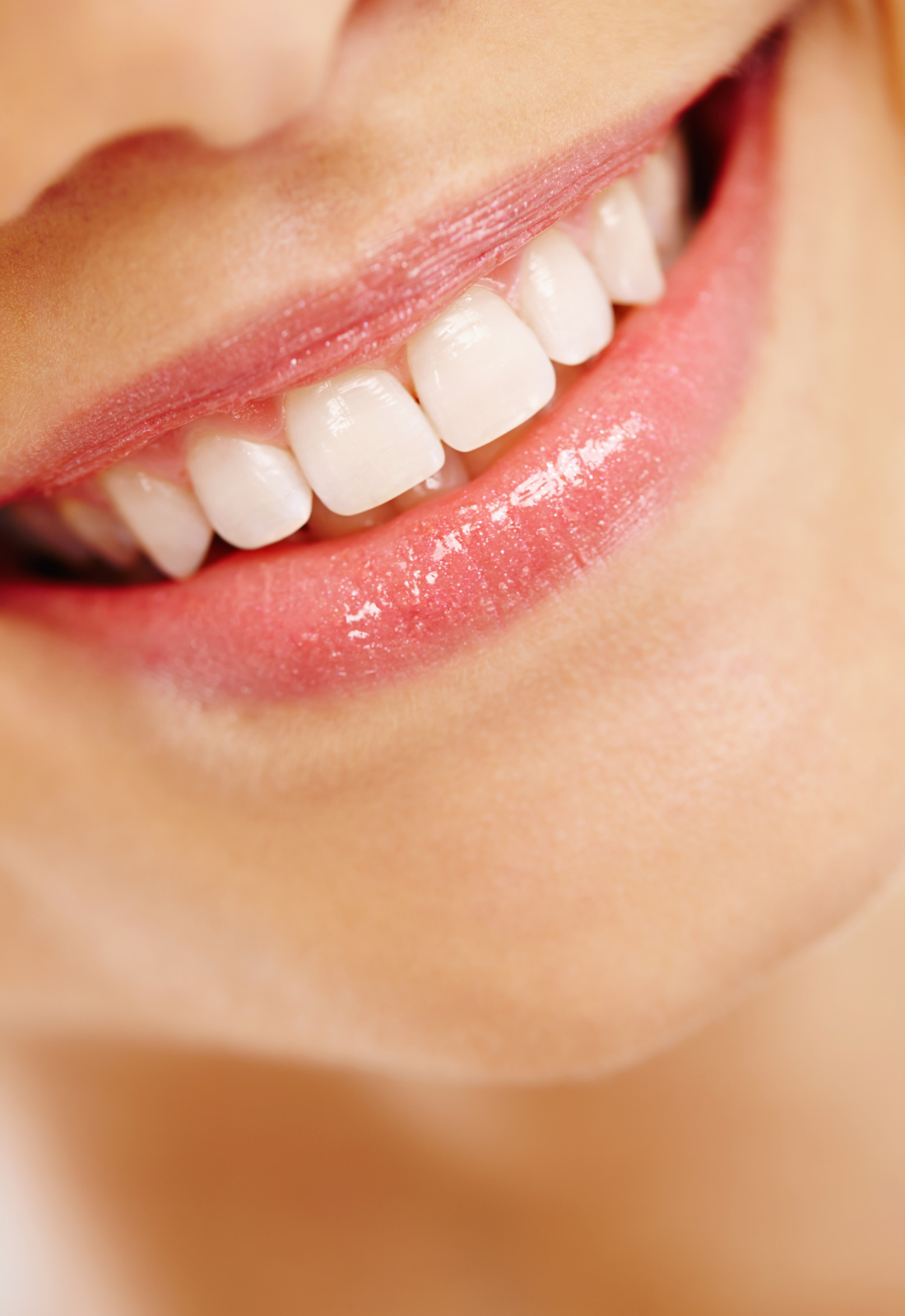 Close up photo of a smiling woman with white teeth.
