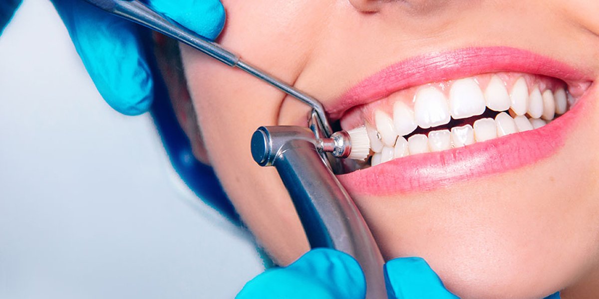 A close-up of teeth being cleaned with a dental polishing tool.