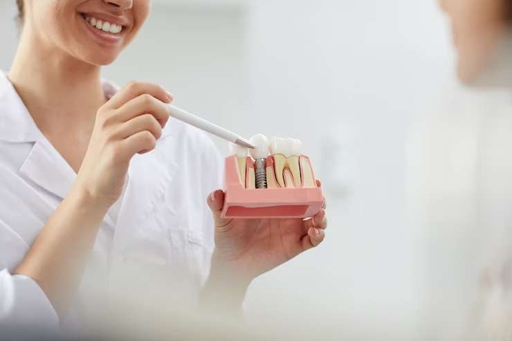 A dentist holding a dental implant model and pointing to it.