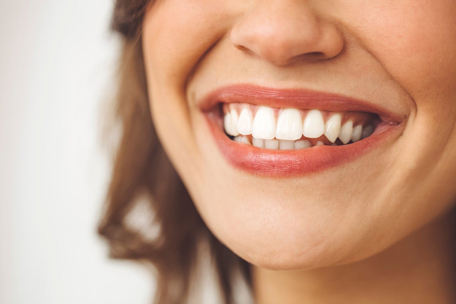 A close-up of a woman smiling and showing her teeth and gums.